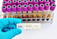 Test for Sexually Transmitted Diseases Near Me