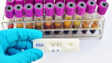 Test for Sexually Transmitted Diseases Near Me