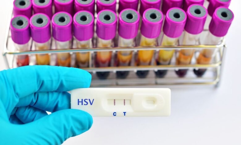 Test for Sexually Transmitted Diseases Near Me